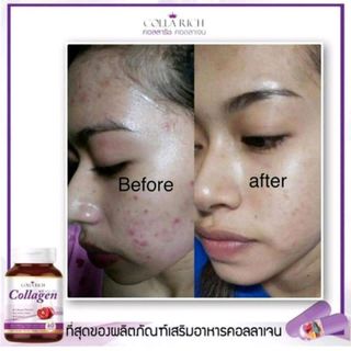 COLLAGEN TRẺ HÓA DA COLLA RICH THÁI LAN