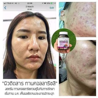 COLLAGEN TRẺ HÓA DA COLLA RICH THÁI LAN