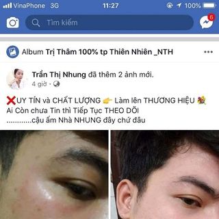 Trị thâm Ngọc Thiên Hương