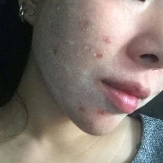 thuốc bắc đông y tái tạo da SẮCVÂN