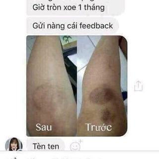 Trị thâm Ngọc Thiên Hương