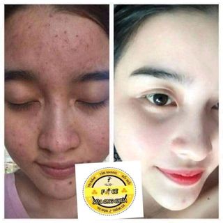 kích trắng sữa ong chúa