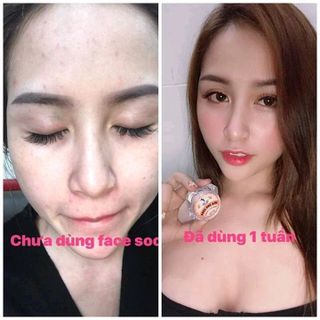 kích trắng sữa ong chúa