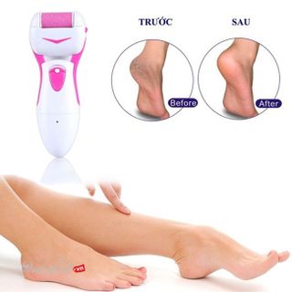 MÁY CHÀ GÓT TẨY DA CHAI CHÂN AN TOÀN SHINON
