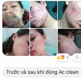 Sirum Trị Mụn Hot Nhất Hàn Quốc