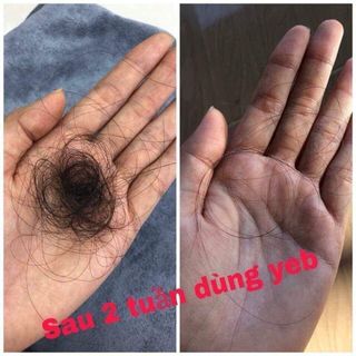 Dầu Gội Hàn Quốc 3in1 - Chuyên Trị Gầu Kích Mọc Tóc Phục Hồi Tóc Gãy Rụng và Hư Tổn