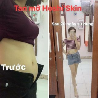 Kem tan mỡ mờ rạn da