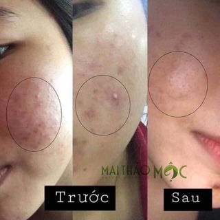 Mai Thảo Mộc Nguyên Chất