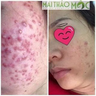 Mai Thảo Mộc Nguyên Chất