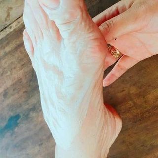 Nước lột thay da