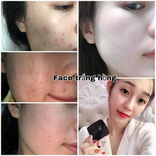Face căng bóng - trắng hồng