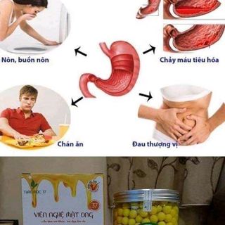 NGHỆ MẬT ONG RỪNG