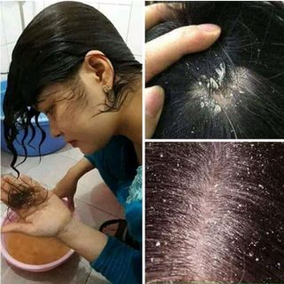 DẦU GỘI ĐẦU THẢO DƯỢC DÂN GIAN