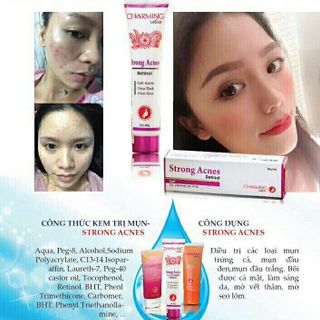 Kem trị mụn Strong Acnes- Charming skin