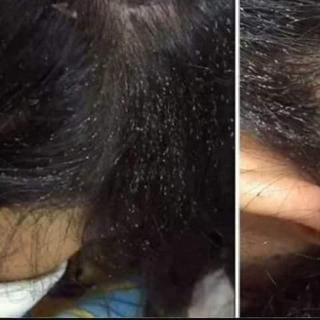 Dầu gội chí chấy chị tấm thanh mộc hương