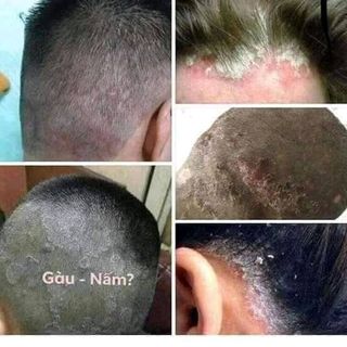 Kem bôi da Thuần Mộc
