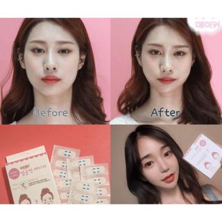 Hộp 40 Miếng Dán VLine