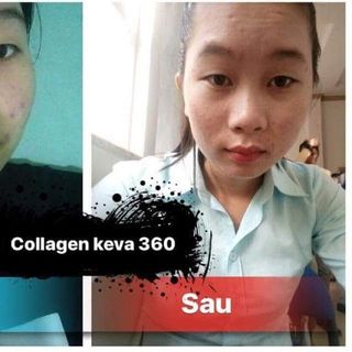 Collagen Keva 360