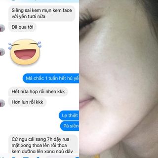 Thuốc đặc trị mụn siêu tốc