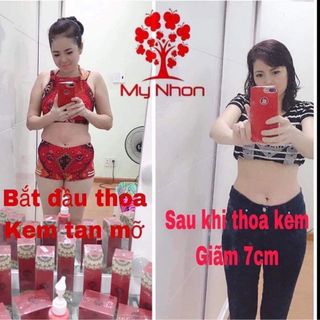 Kem Tan Mỡ Mynhon Số 1 Châu Á - Thái Bình Dương