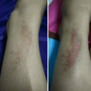 Tinh chất đặc trị thâm thiên nhiên Ngọc Thiên Hương