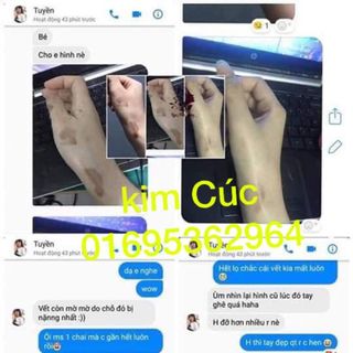 Tinh chất đặc trị thâm thiên nhiên Ngọc Thiên Hương