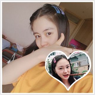 KẸP GIỌT NƯỚC BASIC BẢN TO