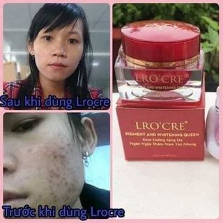 Kem bell Lrocre nữ hoàng trị nám tàn nhang