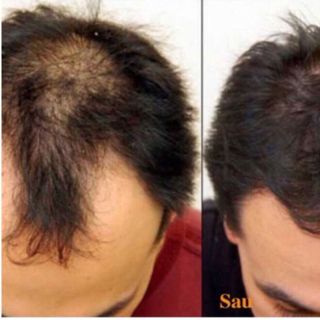 Dầu gội bồ kết hoa bưởi
