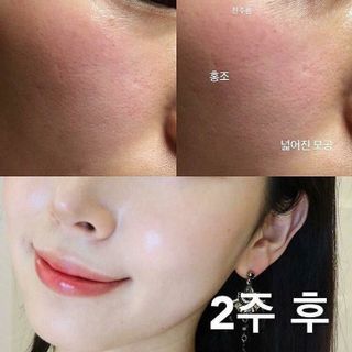 Tinh chất Red Peel Tingle Serum