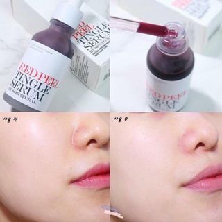 Tinh chất Red Peel Tingle Serum