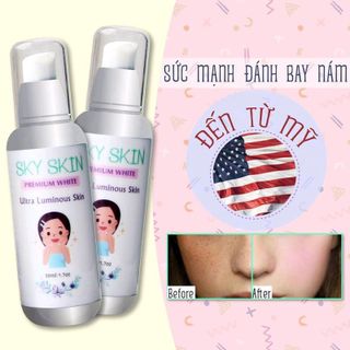Kem dưỡng trắng da trị nám Sky Skin