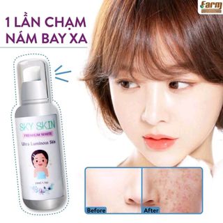 Kem dưỡng trắng da trị nám Sky Skin