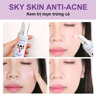 Kem dưỡng trị mụn trứng cá Sky Skin