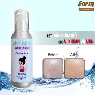 Serum đặc trị mụn trứng cá Sky Skin