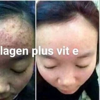 face colagen vit e plus