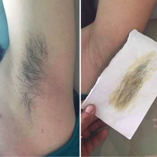 WAX TRIỆT LÔNG VEO