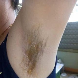 WAX TRIỆT LÔNG VEO