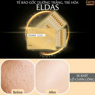 Tế Bào Gốc Dưỡng Trắng Trẻ Hóa Eldas