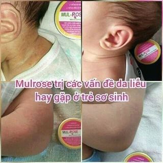 KEM ĐA NĂNG ĐẶC TRỊ VIEM DA CƠ ĐỊA MUL ROSE