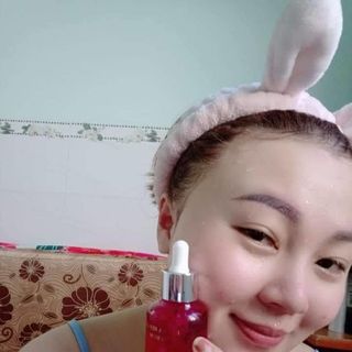 Serum Tảo Non Đặc Trị Mụn Nám và Tàn Nhang dưỡng da sáng mịn YLAGY