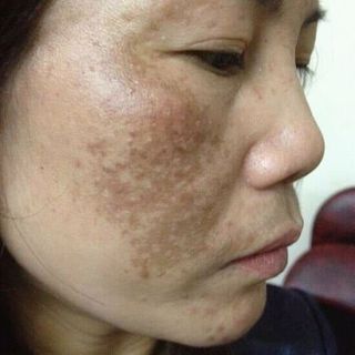 Dược mỹ phẩm Hanayuki