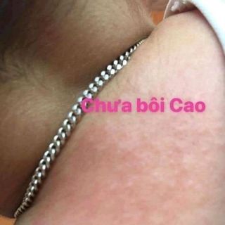 CAO THẢO MỘC ĐA NĂNG