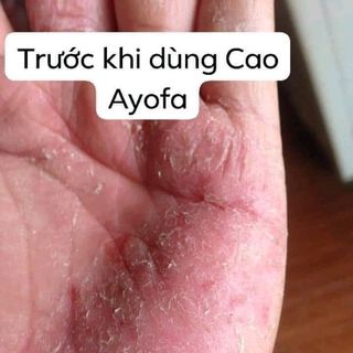 CAO THẢO MỘC ĐA NĂNG