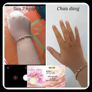 KEM KÍCH TRẮNG