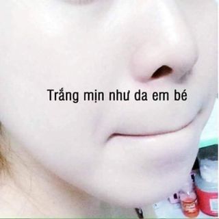 BỘ TRỊ MỤN NÁM TÀN NHANG DƯỠNG TRẮNG DA YANHEE