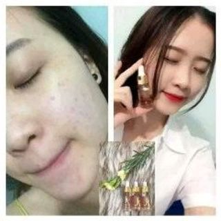 serum kiều