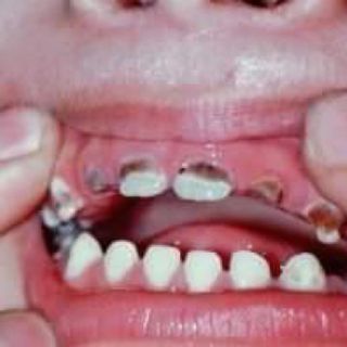Thuốc đặc trị răng miệng An Khánh Tâm