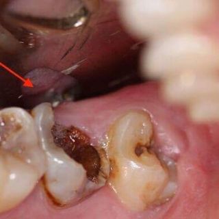 Thuốc đặc trị răng miệng An Khánh Tâm