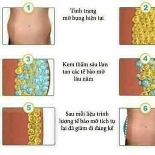 Kem Tan Mỡ Ngân Bình - Kem tan mỡ bụng và đùi